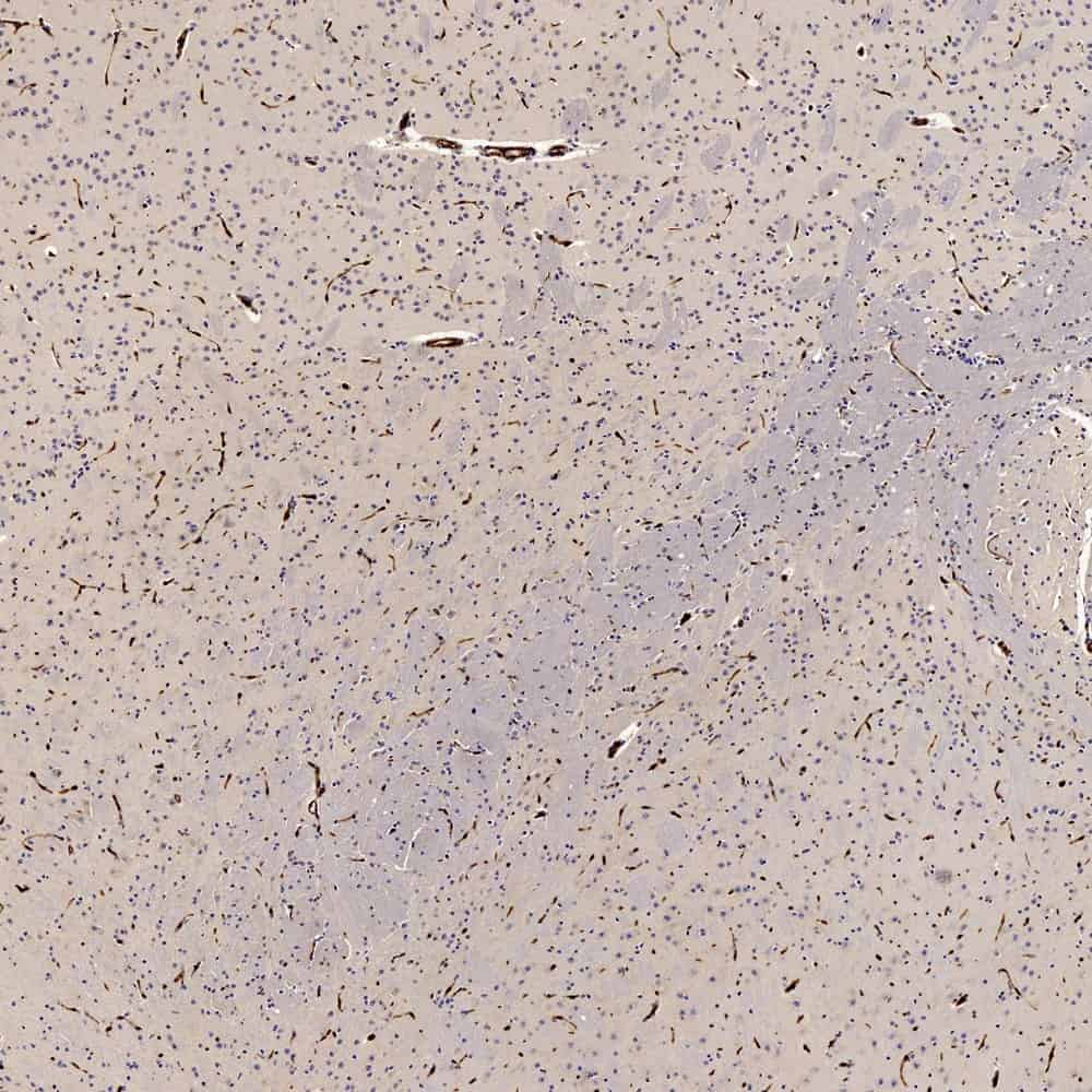 Immunohistochemistry analysis of paraffin-embedded Mouse brain  using GLUT-1 Polyclonal Antibody at dilution of 1:300.