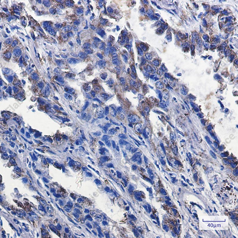 Recombinant P2Y6 Monoclonal Antibody - 3