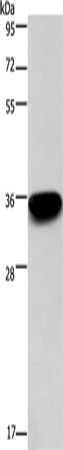 Western Blot analysis of 293T cell using PRPS1/2/PRPS1L1 Polyclonal Antibody at dilution of 1:400