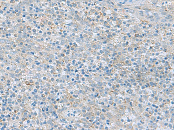 Immunohistochemistry of paraffin-embedded Human tonsil tissue  using PYCR2 Polyclonal Antibody at dilution of 1:40(?200)