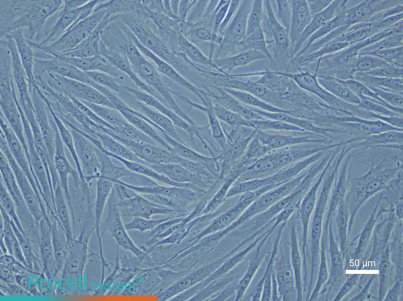 Human Umbilical Vein Smooth Muscle Cell Complete Medium - 5