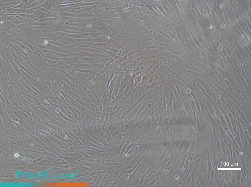 Human Sertoli (Primary cell immortalization) Cell Complete MediumHuman Sertoli (Primary cell immortalization) Cell Complete Medium - 1