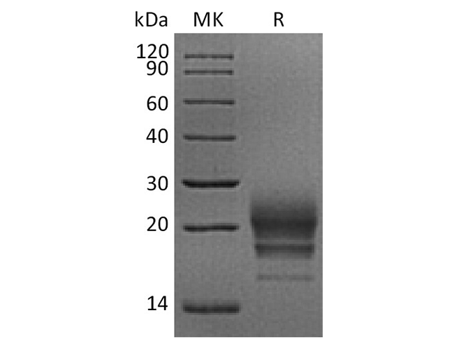 Recombinant Rhesus macaque CD160 Protein (His Tag)