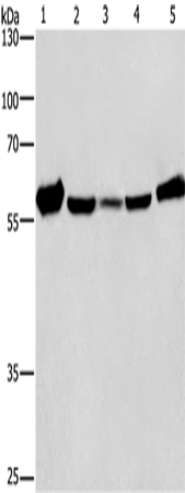 Western Blot analysis of Mouse liver tissue and Raji cell, hela, hepG2 and A549 cell using CAT Polyclonal Antibody at dilution of 1:266.6