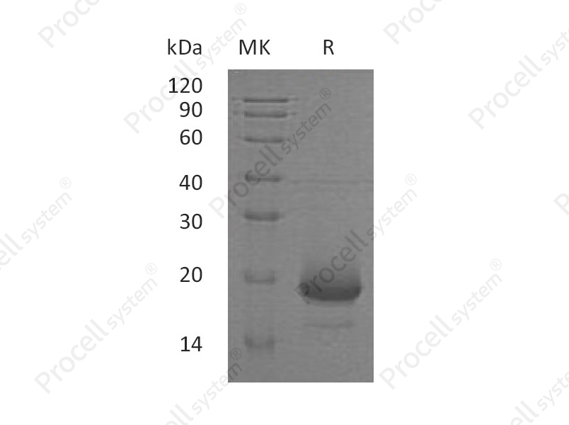 IL-4/BSF-1 (C-6His), Human, Recombinant