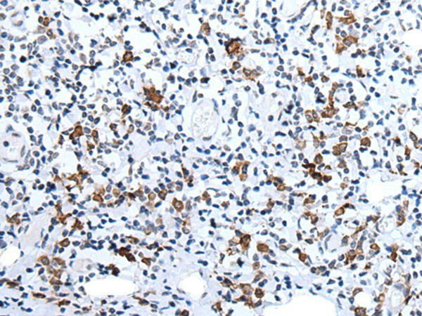 Immunohistochemistry of paraffin-embedded Human tonsil tissue  using HCRT Polyclonal Antibody at dilution of 1:25(?200)