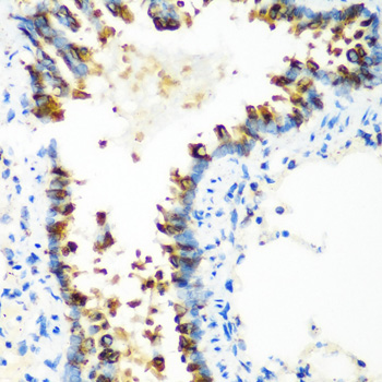 Immunohistochemistry of paraffin-embedded Rat lung using MTCO2 Polyclonal Antibody at dilution of 1:100 (40x lens).