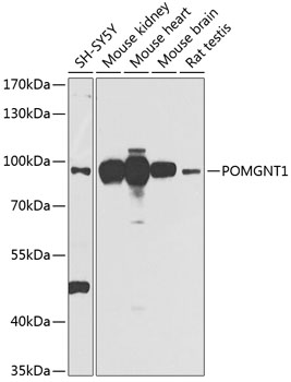 Western blot analysis of extracts of various cell lines using POMGNT1 Polyclonal Antibody at 1:1000 dilution.