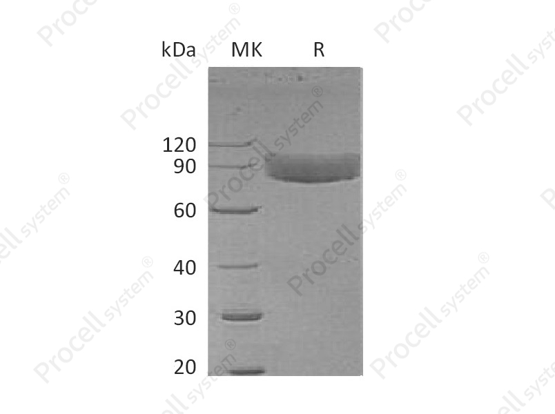 IL-1R-1/CD121a (C-Fc), Human, Recombinant