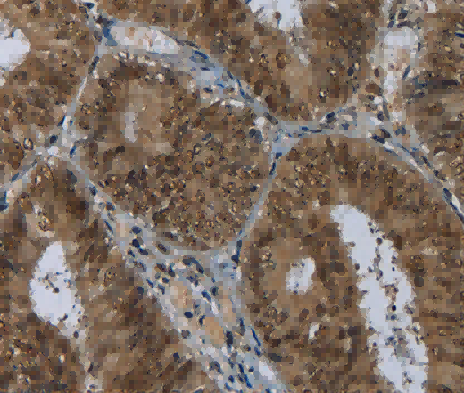 MRE11 Polyclonal Antibody - 2