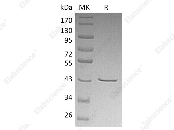 Recombinant Human CHI3L2/YKL-39 Protein (His Tag) - 1