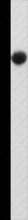 MAP2K6 Polyclonal Antibody - 1