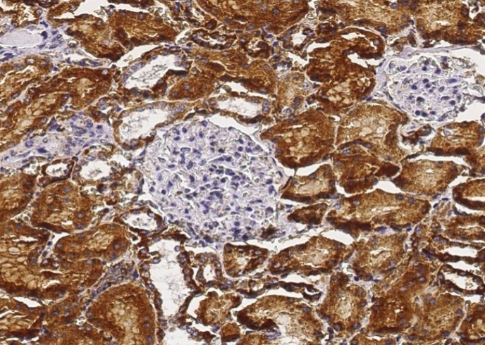 Recombinant Carbonic Anhydrase IV/CA4 Monoclonal Antibody - small - 2