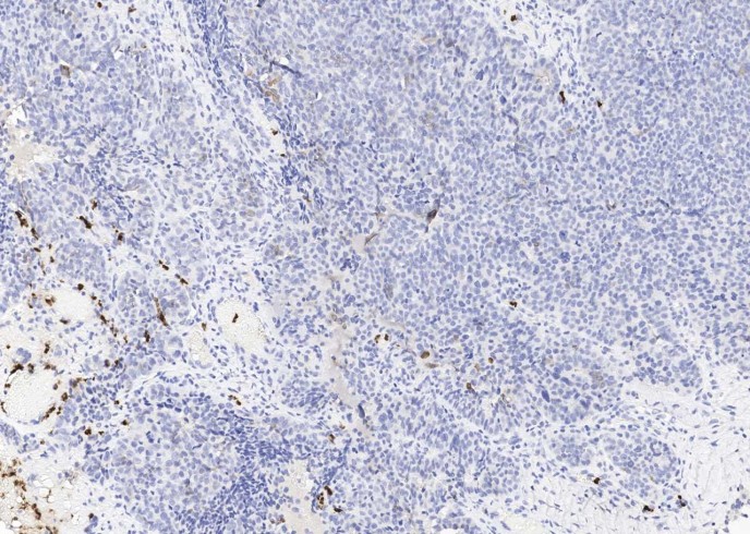 Recombinant Lipocalin-2/LCN2 Monoclonal Antibody-searchlist-1