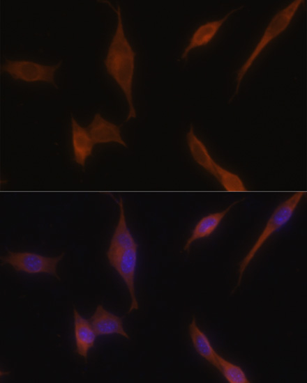 Immunofluorescence analysis of NIH-3T3 cells using MLPH Polyclonal Antibody at dilution of 1:100. Blue: DAPI for nuclear staining.