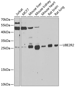 Western blot analysis of extracts of various cell lines using UBE2R2 Polyclonal Antibody at 1:1000 dilution.