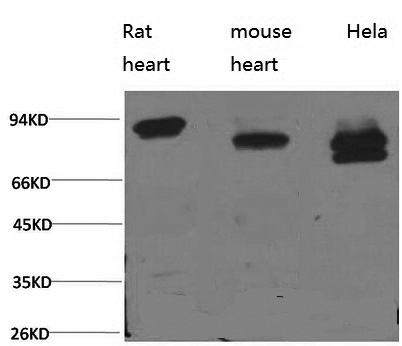 Western Blot analysis of 1) Rat heart, 2) Mouse heart, 3) Hela using STAT3 Monoclonal Antibody at dilution of 1:2000.