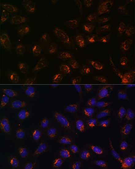 Immunofluorescence analysis of U-2 OS cells using ITPR1 Polyclonal Antibody at dilution of  1:100. Blue: DAPI for nuclear staining.