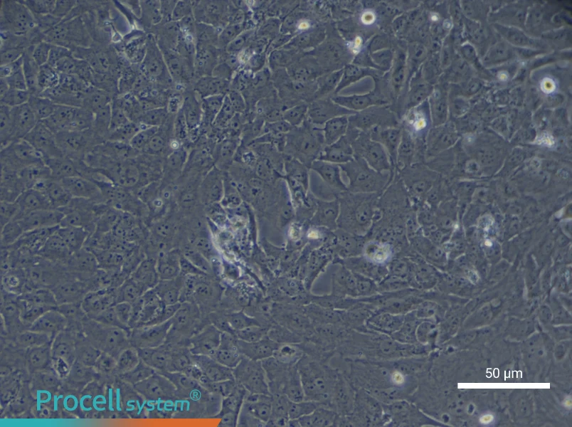 Human Type II Alveolar Epithelial (Primary cell immortalization) Cell Complete Medium - 12