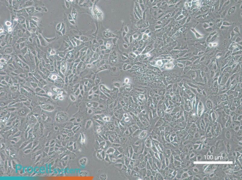 NCI-H1666 Cell Complete Medium - 2