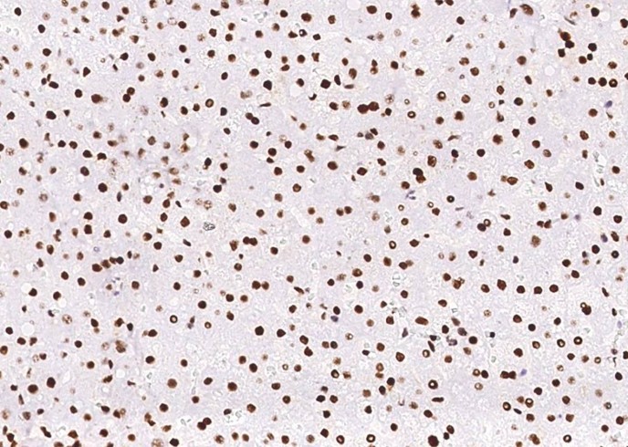 Recombinant PCNA Monoclonal Antibody-searchlist-1