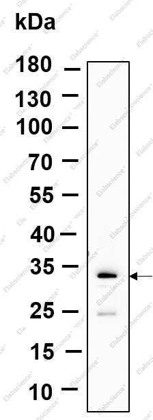 Recombinant SLBP Monoclonal Antibody - 1