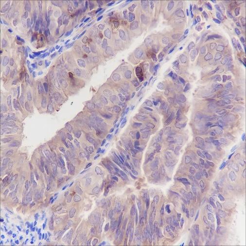 Recombinant ARPC5/p16 ARC Monoclonal Antibody - 3
