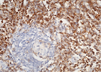 Recombinant CD4 Monoclonal Antibody - small - 2