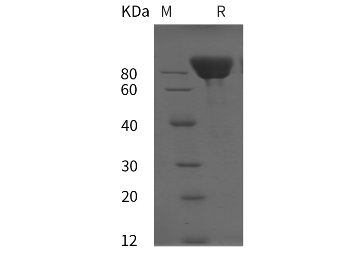Recombinant Mouse IL-21 Protein(Sumo Tag)-产品推荐-1