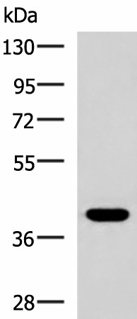 Western blot analysis of HepG2 cell lysate  using PLPPR5 Polyclonal Antibody at dilution of 1:1500