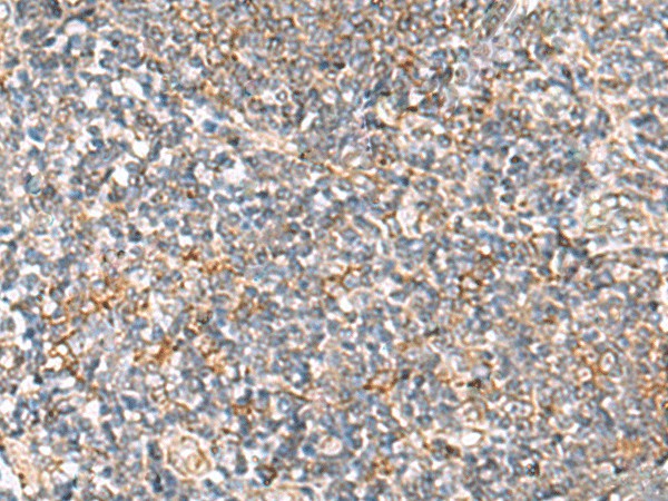 Immunohistochemistry of paraffin-embedded Human tonsil tissue  using HLA-DOB Polyclonal Antibody at dilution of 1:40(?200)