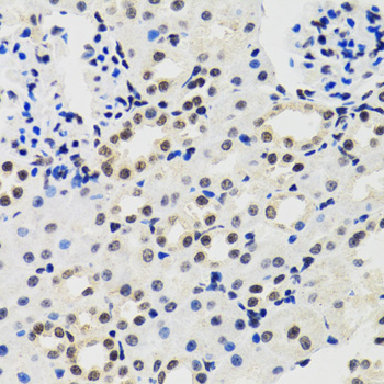 Immunohistochemistry of paraffin-embedded Mouse kidney using CIRBP Polyclonal Antibody at dilution of  1:100 (40x lens).