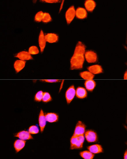 Immunofluorescence analysis of Hela cells using DNAJC19 Polyclonal Antibody at dilution of 1:100 (40x lens). Blue: DAPI for nuclear staining.