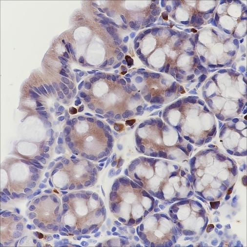 Recombinant eIF3B Monoclonal Antibody - 3