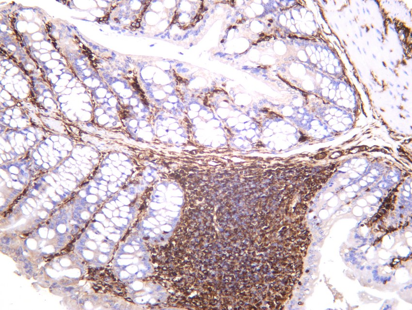 Recombinant Vimentin Monoclonal Antibody - small - 4