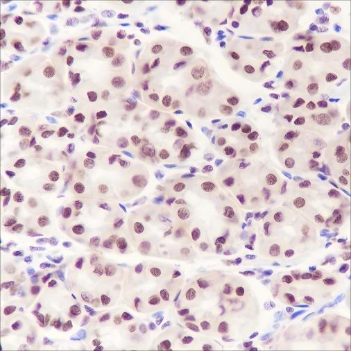 Recombinant DNMT1 Monoclonal Antibody - small - 2