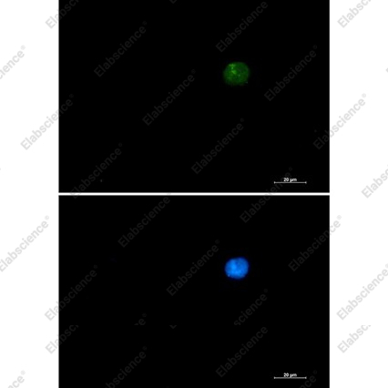 Recombinant SMARCA2/BRM Monoclonal Antibody - 3
