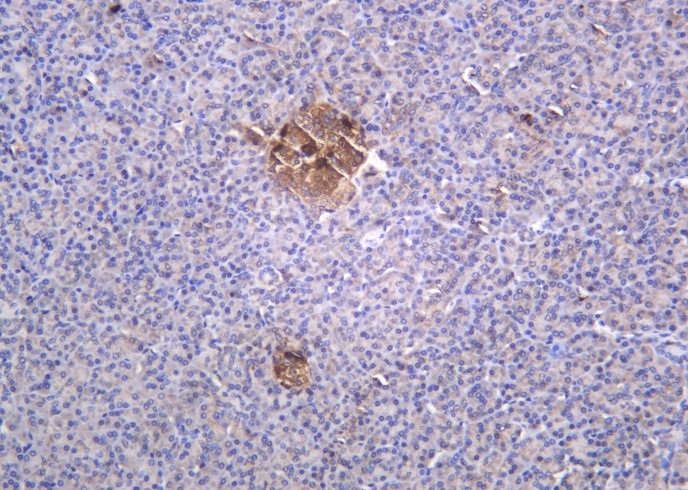 Recombinant Glucagon Monoclonal Antibody - 1