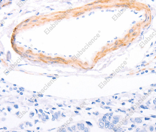 TPM1 Polyclonal Antibody - 2