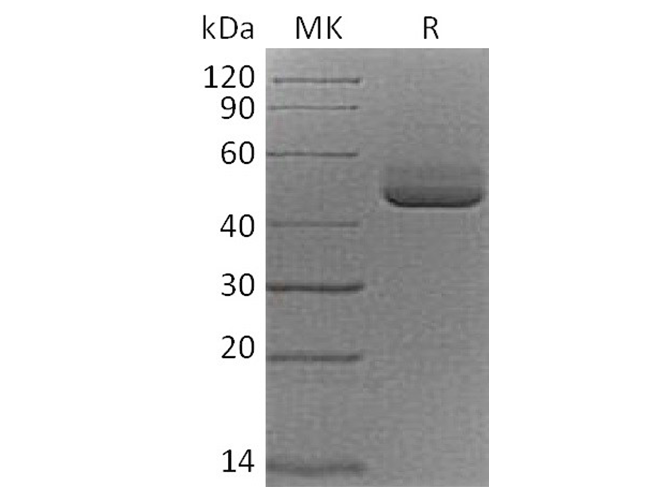 Recombinant Cynomolgus TIGIT/VSIG9/VSTM3 Protein (Fc Tag)