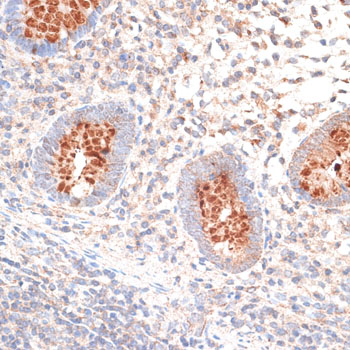 Immunohistochemistry of paraffin-embedded human appendix using KIR3DL3 Polyclonal antibody at dilution of 1:100 (40x lens).Perform microwave antigen retrieval with 10 mM PBS buffer pH 7.2 before commencing with IHC staining protocol.