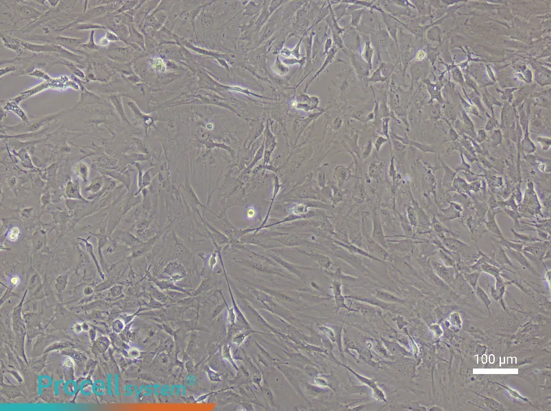 Mouse Brain Fibroblast Complete Medium - 2