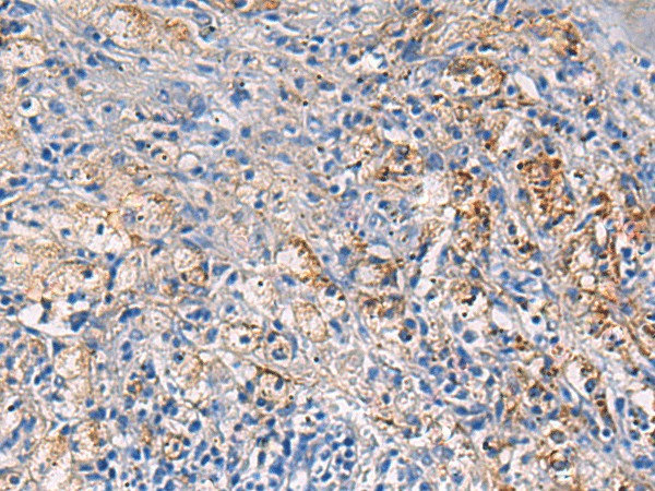 Immunohistochemistry of paraffin-embedded Human brain tissue  using NFKB1 Polyclonal Antibody at dilution of 1:80(?200)