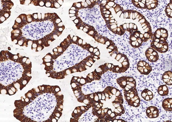 Cytokeratin 8 Monoclonal Antibody - small - 4