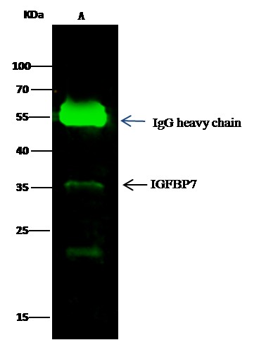 Recombinant IGFBP7 Monoclonal Antibody - small - 1