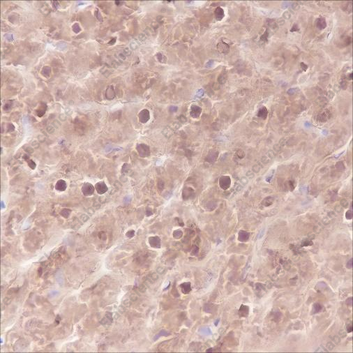 Recombinant SETBP1 Monoclonal Antibody - 5