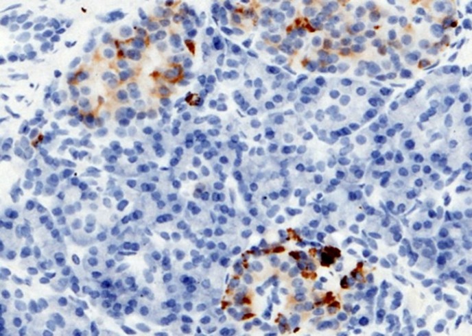RBP4 Monoclonal Antibody - small - 1