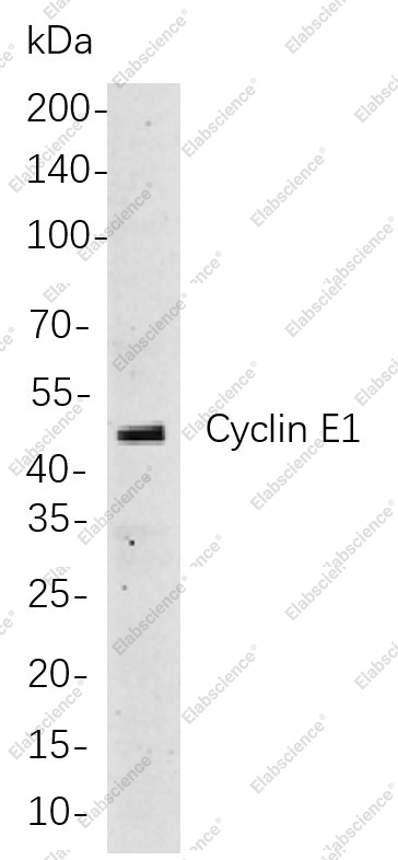 Recombinant Cyclin E1 Monoclonal Antibody - 1
