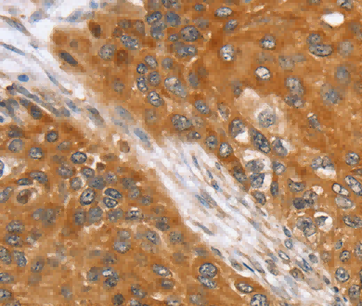 SLC25A13 Polyclonal Antibody - 2