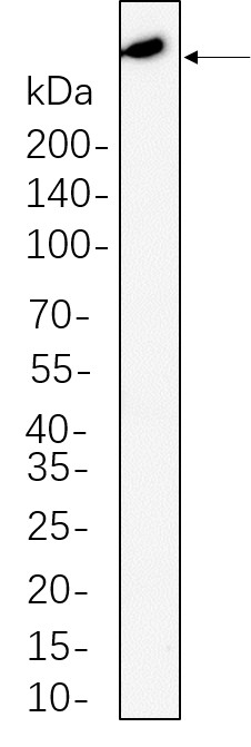 Recombinant ATM Monoclonal Antibody-searchlist-1